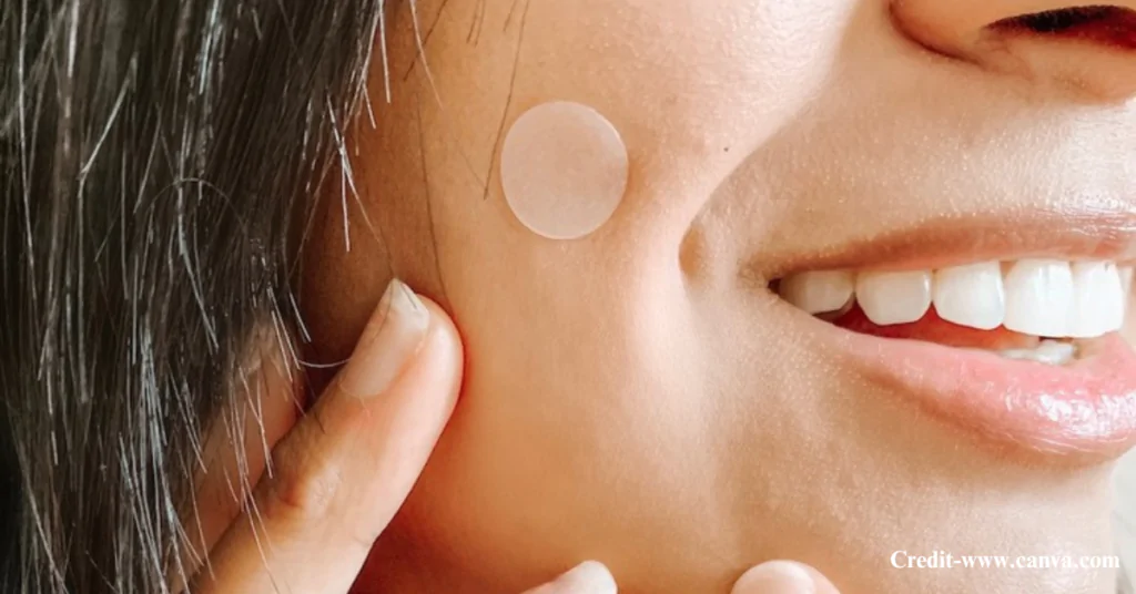 Benefits of Using Pimple Patches