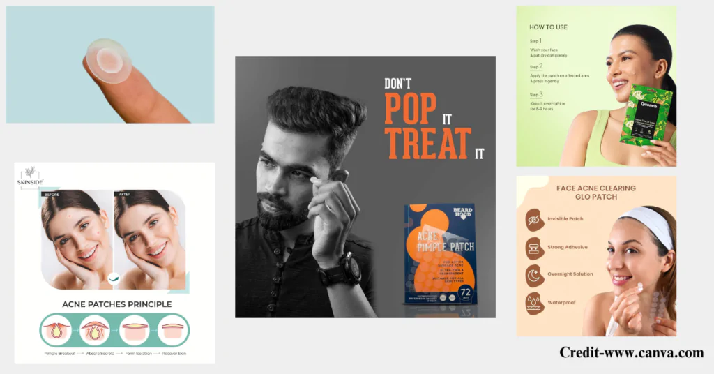 Top 5 Pimple Patches to Try