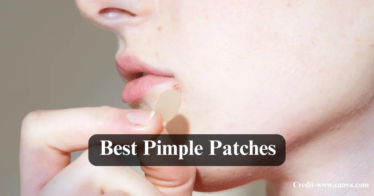 The Ultimate Guide to Pimple Patches